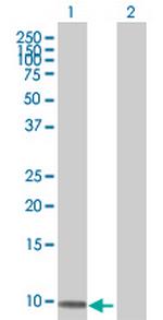 ZNF544 Antibody in Western Blot (WB)