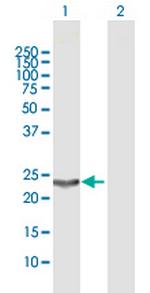 PGDS Antibody in Western Blot (WB)