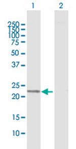 PGDS Antibody in Western Blot (WB)