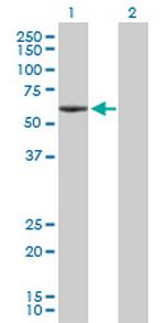 ANGPTL3 Antibody in Western Blot (WB)