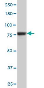 RPS6KA6 Antibody in Western Blot (WB)