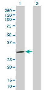 PCSK1N Antibody in Western Blot (WB)