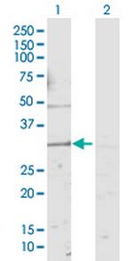 KCNMB4 Antibody in Western Blot (WB)