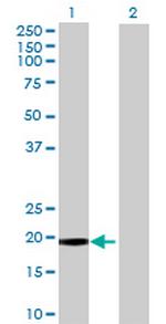 MT Antibody in Western Blot (WB)