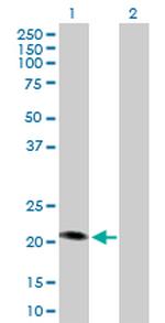 MCAT Antibody in Western Blot (WB)