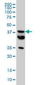 MT Antibody in Western Blot (WB)