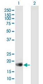 APOBEC3C Antibody in Western Blot (WB)