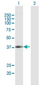 DCPS Antibody in Western Blot (WB)