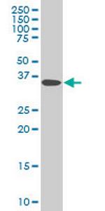 DCPS Antibody in Western Blot (WB)