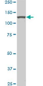 HIPK2 Antibody in Western Blot (WB)