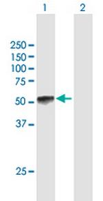 KLF15 Antibody in Western Blot (WB)