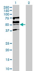 KLF15 Antibody in Western Blot (WB)