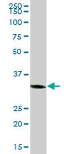 C1GALT1C1 Antibody in Western Blot (WB)