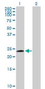 UBE2T Antibody in Western Blot (WB)