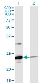 UBE2T Antibody in Western Blot (WB)