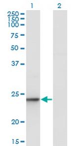 UBE2T Antibody in Western Blot (WB)