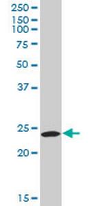 PYCARD Antibody in Western Blot (WB)