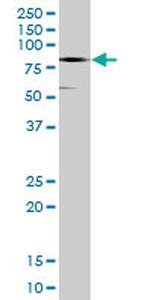 CTNNA3 Antibody in Western Blot (WB)