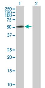 CTNNA3 Antibody in Western Blot (WB)