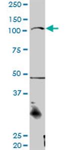 CTNNA3 Antibody in Western Blot (WB)