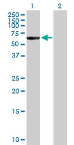 CTNNA3 Antibody in Western Blot (WB)