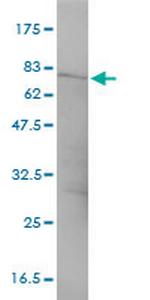 CTNNA3 Antibody in Western Blot (WB)