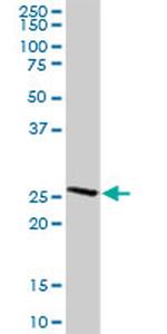 CLEC2D Antibody in Western Blot (WB)