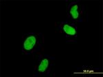 UHRF1 Antibody in Immunocytochemistry (ICC/IF)