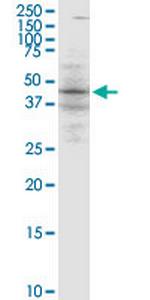 BLNK Antibody in Western Blot (WB)