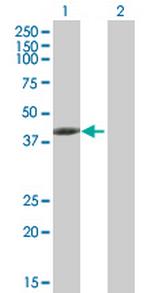 TMOD3 Antibody in Western Blot (WB)