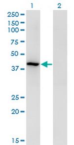 TMOD3 Antibody in Western Blot (WB)