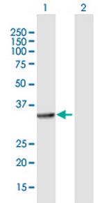 ALG5 Antibody in Western Blot (WB)