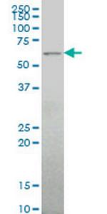 ALG6 Antibody in Western Blot (WB)