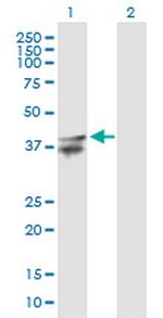 LASS2 Antibody in Western Blot (WB)