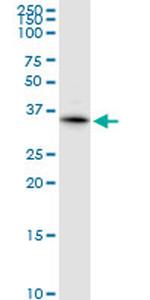 KCNIP2 Antibody in Western Blot (WB)