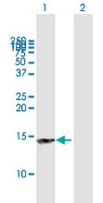 NT5C Antibody in Western Blot (WB)