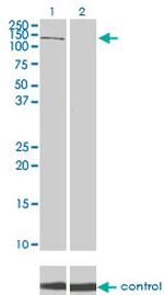 PIK3R4 Antibody in Western Blot (WB)