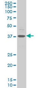 CHST11 Antibody in Western Blot (WB)