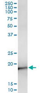 NEUROG3 Antibody in Immunoprecipitation (IP)