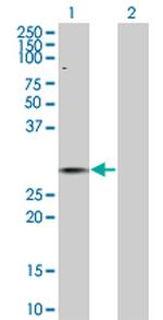 NEUROG3 Antibody in Western Blot (WB)