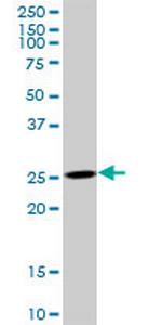 AK3 Antibody in Western Blot (WB)