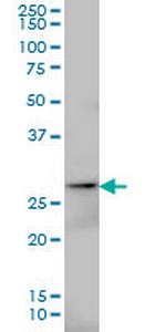 AK3 Antibody in Western Blot (WB)