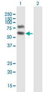 HP1BP3 Antibody in Western Blot (WB)