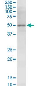 NSDHL Antibody in Western Blot (WB)