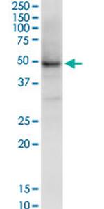 NSDHL Antibody in Western Blot (WB)