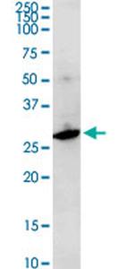 F11R Antibody in Western Blot (WB)