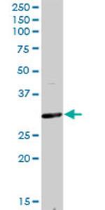 F11R Antibody in Western Blot (WB)