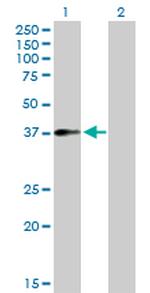 F11R Antibody in Western Blot (WB)