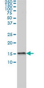 MED31 Antibody in Western Blot (WB)