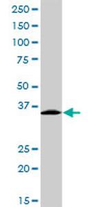 EXOSC3 Antibody in Western Blot (WB)